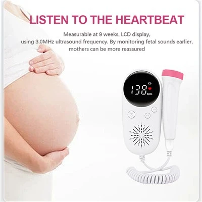 Doppler thai nhi trong cửa hàng